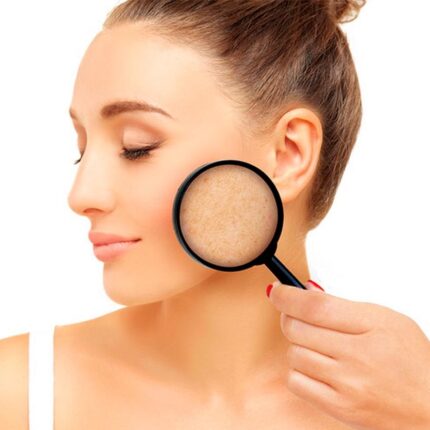 Cilt lekeleri  kabusunuz olmasın