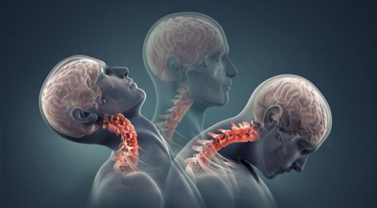 Boyun Fıtığında Erken Tanı ve Tedavi Uyarısı