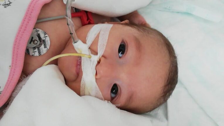 Umay Affet Bizi Kızım… Küçük Bedenine Hayat Veremedik!