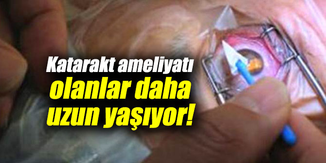 “KATARAKT AMELİYATI OLAN HASTALAR DAHA UZUN YAŞIYOR”