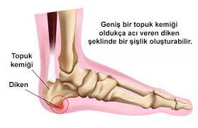 Nazlı Ekici ayak sağlığının gönüllü Podolog’u  Nazlı Ekici Türkiye ‘de rekor üstüne rekor kırmaya devam ediyor…