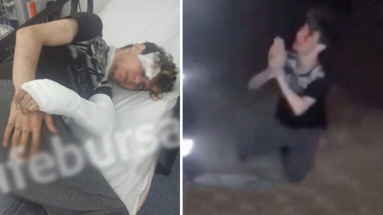 Ülkemizde Mülteci İstemiyoruz…. Bugün Erkan’a yarın hepimize ….