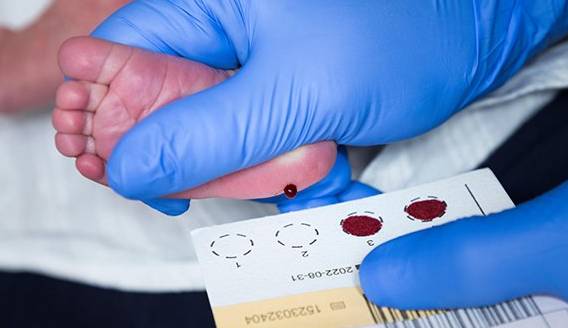 TOPUK KANI ZORUNLU MU?