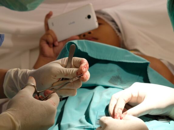 HİPOSPADİAS TEDAVİ EDİLMEZSE ÜREME SORUNLARINA YOL AÇABİLİYOR