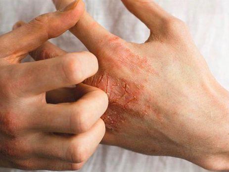 Prof. Dr. Serdar Ceylaner: “Cilt rahatsızlıkları farklı hastalıkların habercisi olabilir”