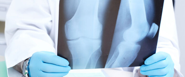 KANSERİN KEMİKLERE YAYILDIĞININ 8 İŞARETİNE DİKKAT!