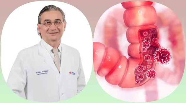 KOLON KANSERİNDE ERKEN TANI VE TEDAVİ HAYAT KURTARIYOR