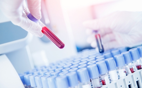 Hakikat yazdı; SMA Testi!