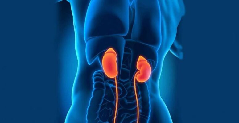 HER 100 KİŞİDEN 13’Ü BÖBREK TAŞI RAHATSIZLIĞI YAŞIYOR