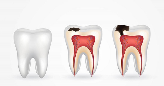 Dişler dökülse de, akıl yerinde kalsın yeter!