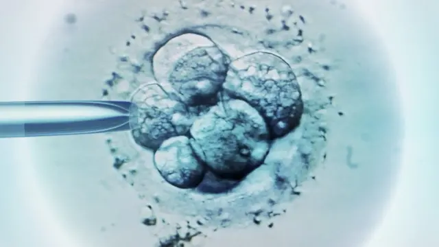 Hollanda’da Şok Doğurganlık Skandalı: Eski Doktorun Kendi Spermini Kullandığı İddiası Gündemde