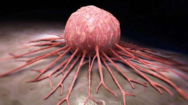 KANSER DEĞİL ,İHMAL ÖLDÜRÜR..!!